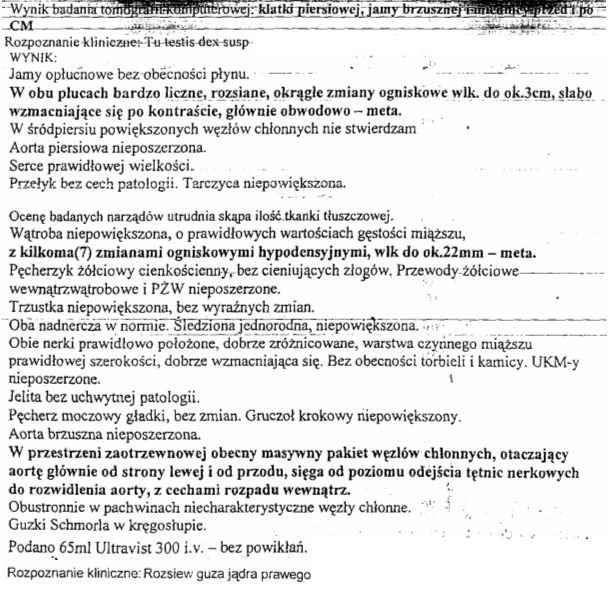 szz1011 tk  kl piersiowej ,jamy brzusznej i miednicy przed i po CM.jpg