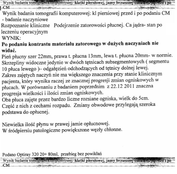 szz1011 tk  kl piersiowej przed i po podaniu CM.jpg